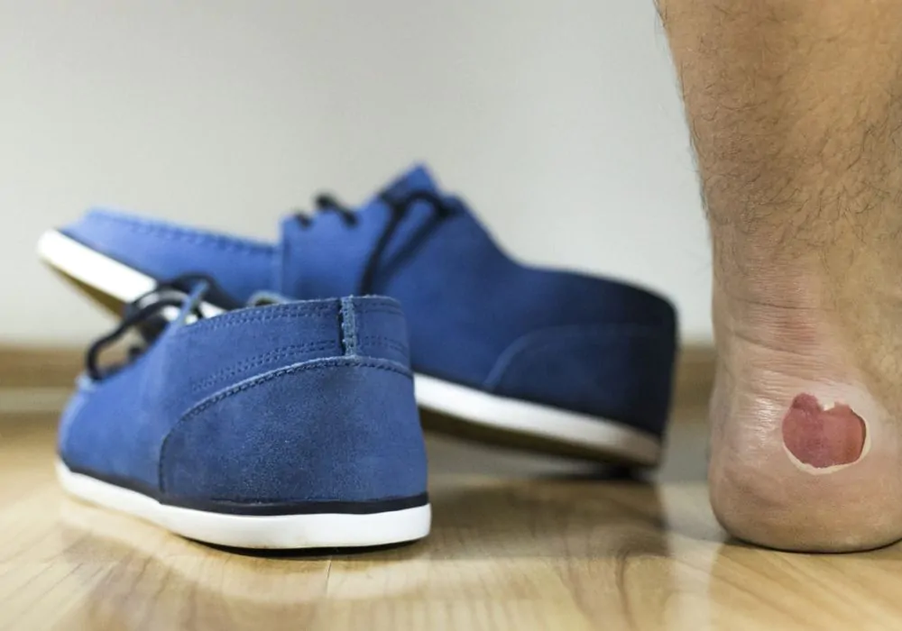 Como cuidar da pele dos pés para quem usa sapato fechado?