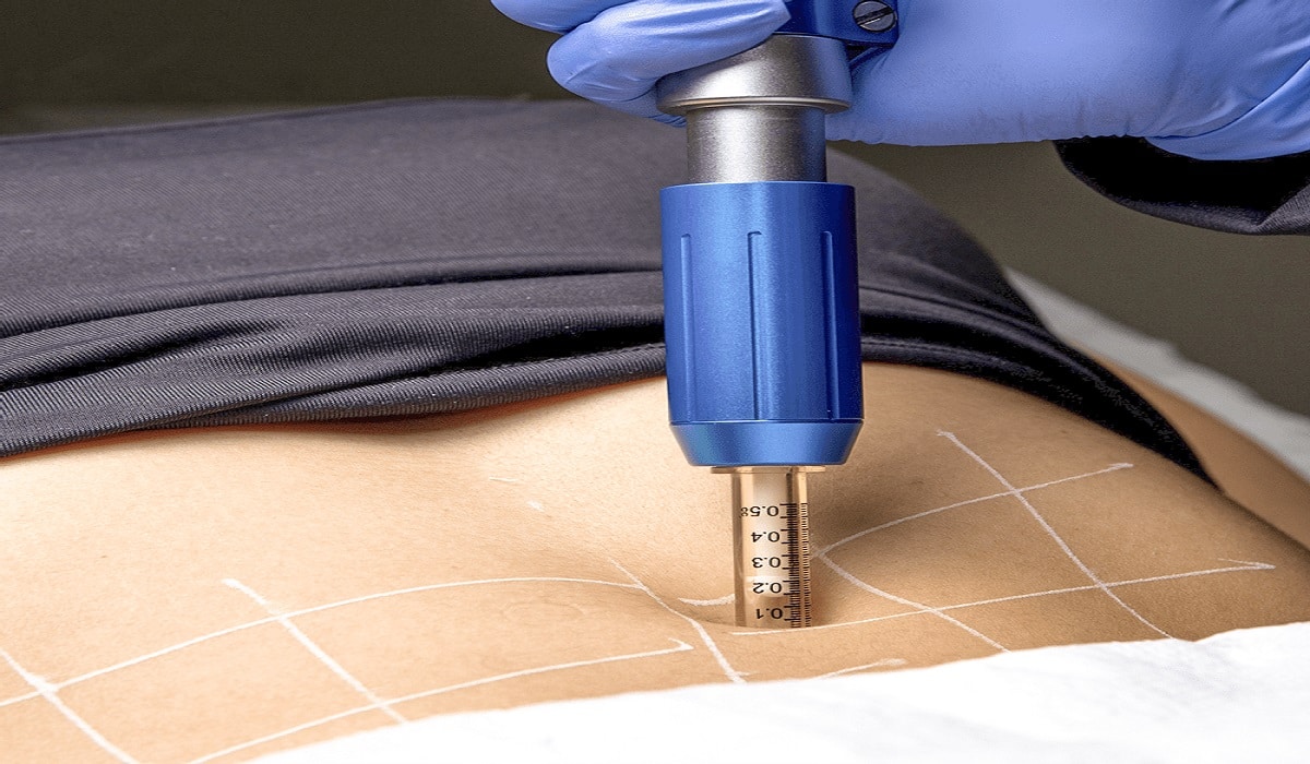 O que é a Intradermoterapia Pressurizada?