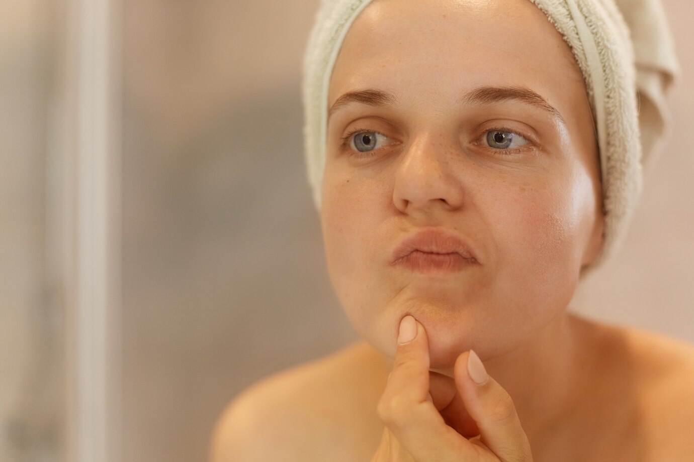 Peeling para cicatrizes de acne: como funciona e benefícios